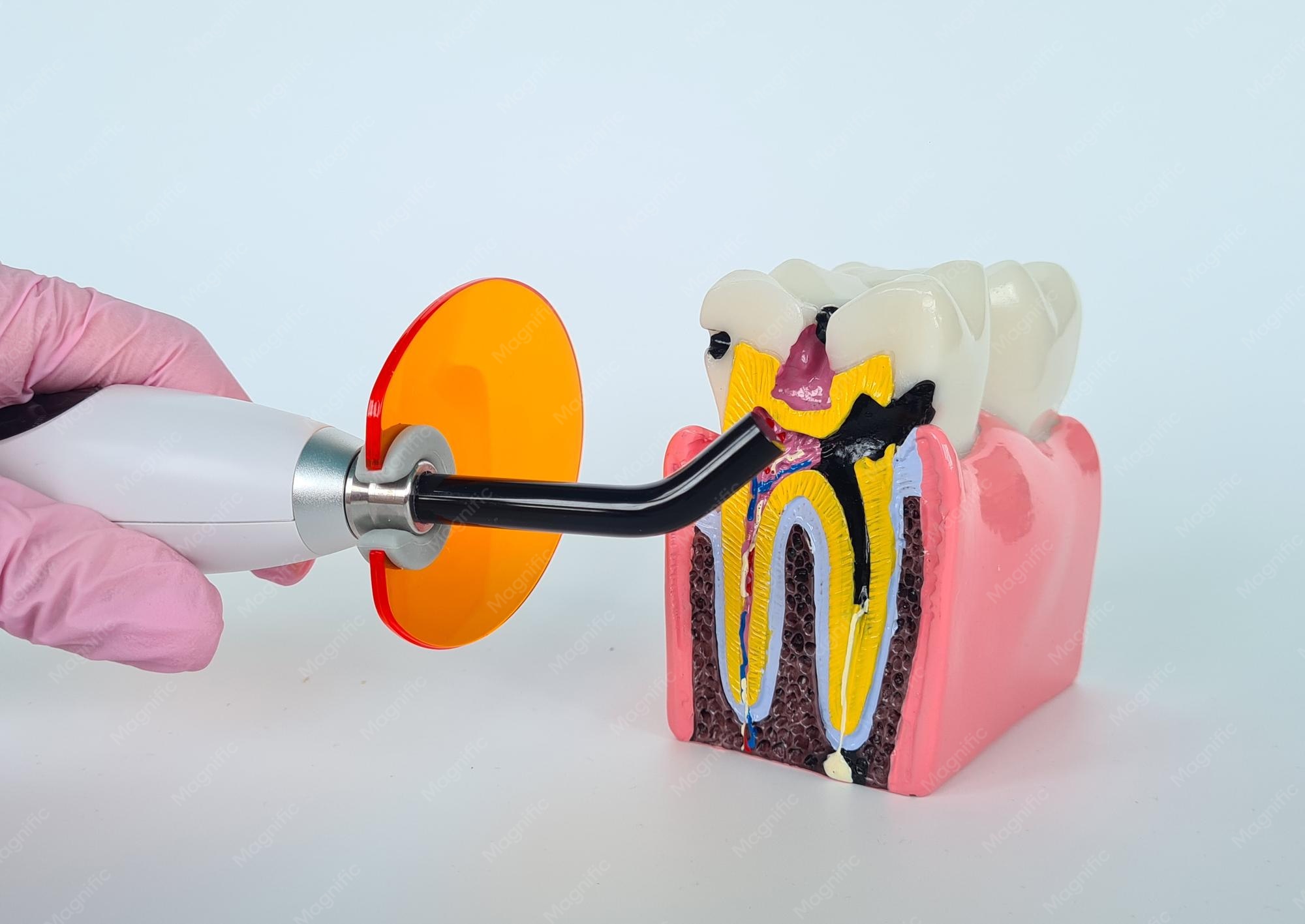 How Do You Know If You Need a Root Canal Treatment